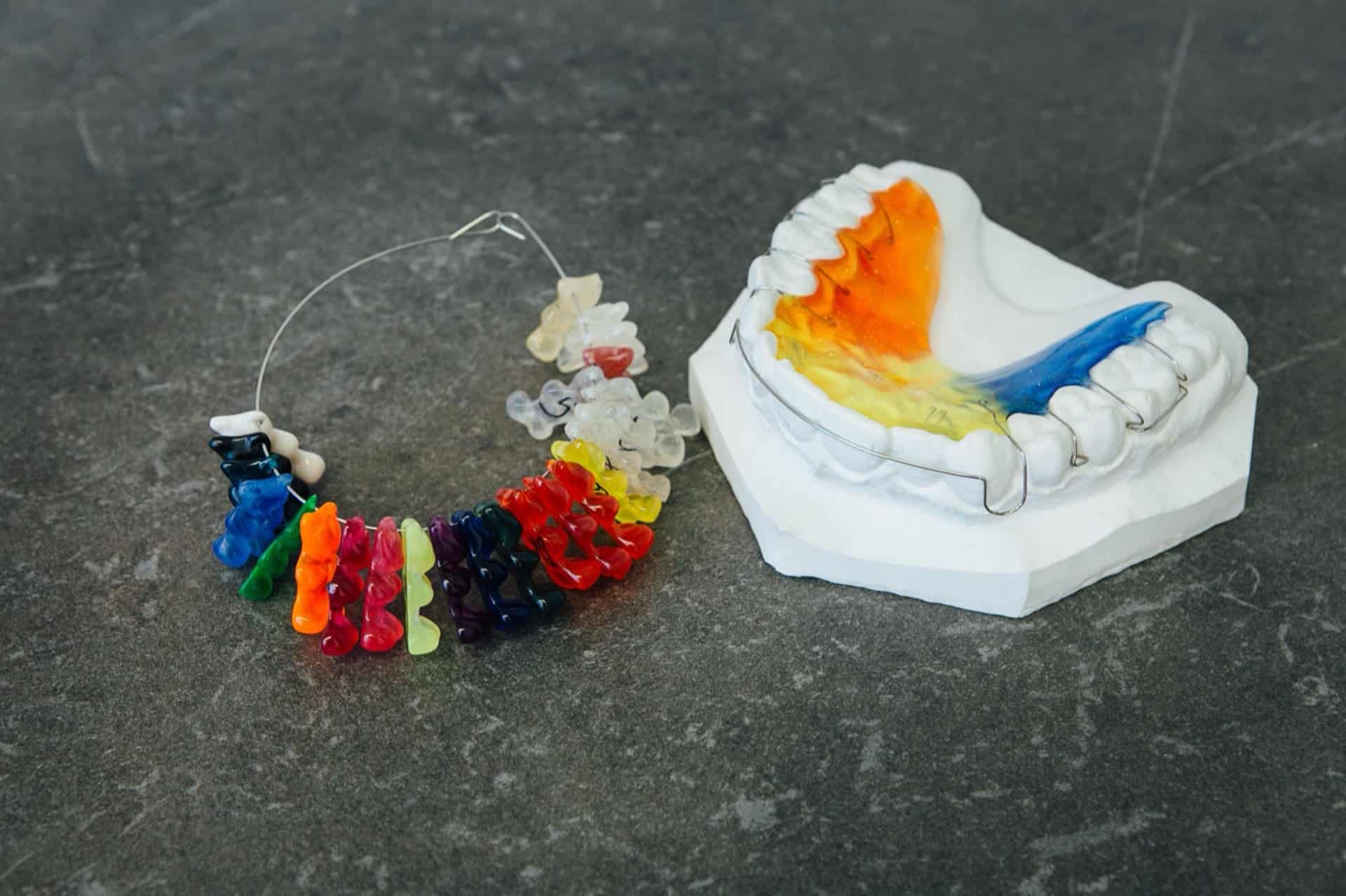 Zahnabdruck für eine Zahnspange mit verschiedenen Farbmuster-Beispielen zur Auswahl.