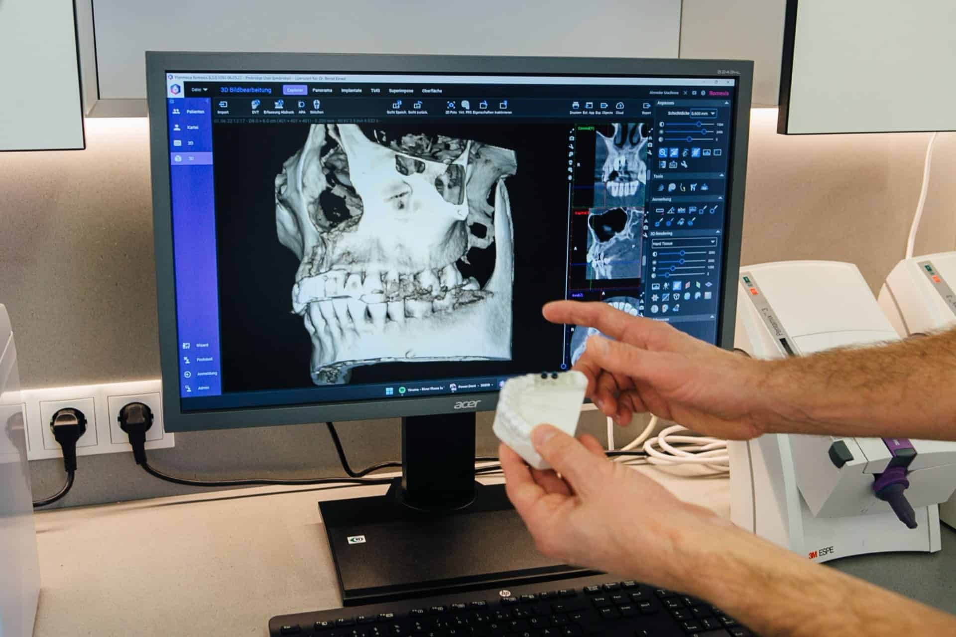 Computerbildschirm mit einem Röntgenbild von Zähnen zur diagnostischen Beurteilung