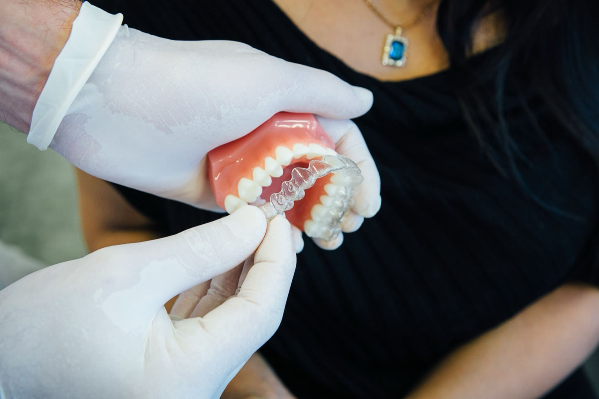 Transparentes Aligner-System auf einem Zahnmodell dargestellt.